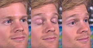 Blinking Guy Meme Origin: How Drew Scanlon Became the Internet's Most Famous Reaction GIF