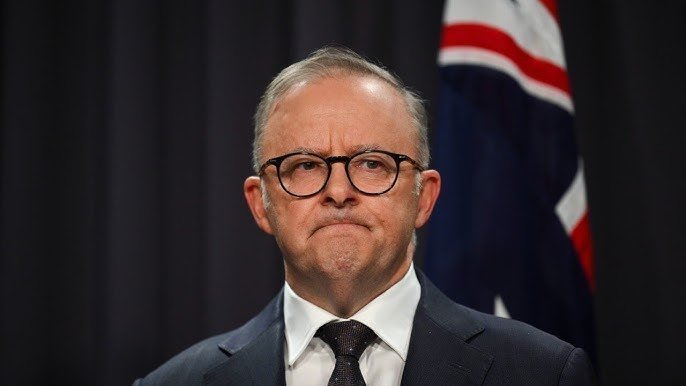 Anthony Albanese Meme Template
