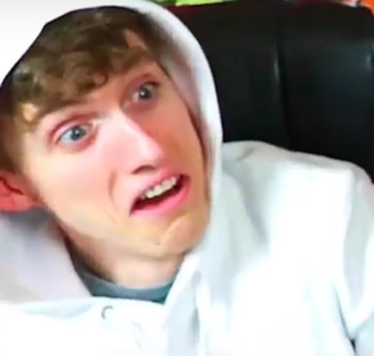 UnitedGamer Confused Face Meme Template