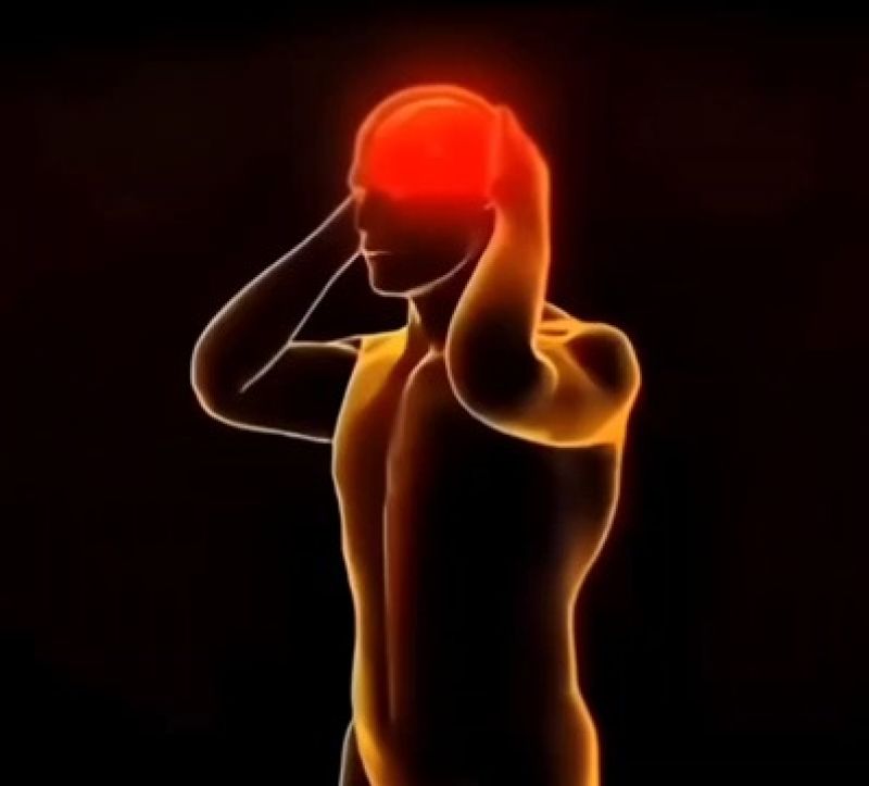 Headache Meme Template Download